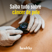 T11E7: Saiba tudo sobre câncer de pele