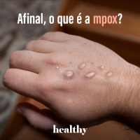 T13E1: Afinal, o que é a mpox?