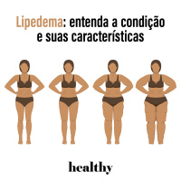T14E10 - Lipedema: entenda a condição e suas características